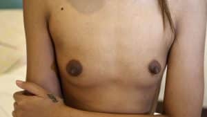 Tiny bare Laos tits